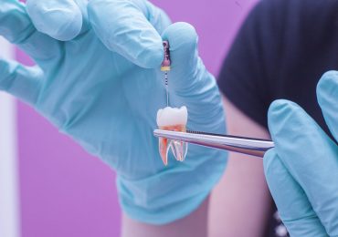 Endodoncja – Saskie Centrum Zdrowia i Odnowy
