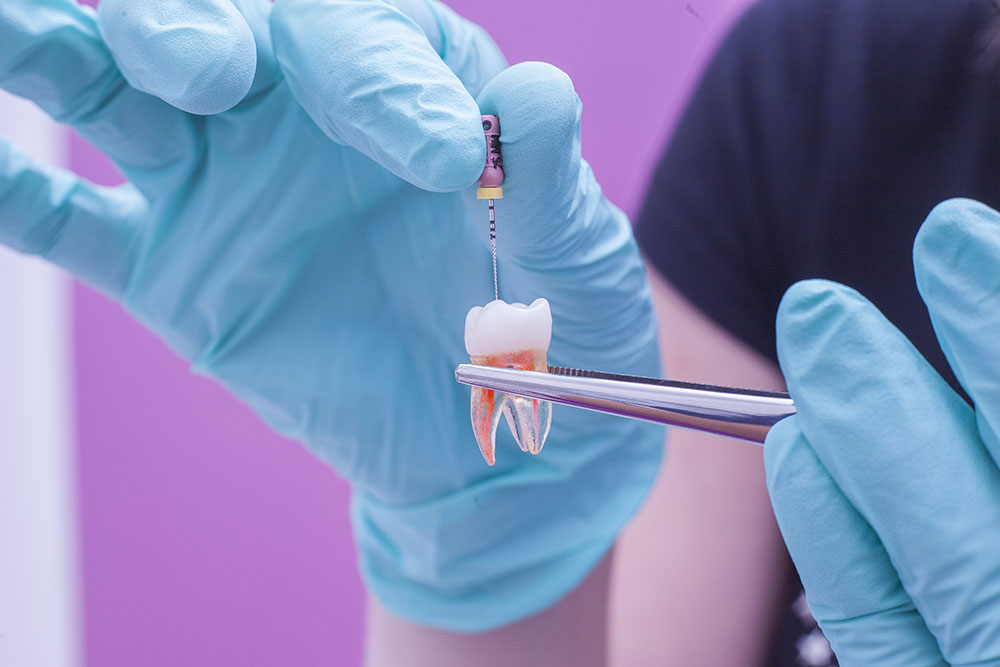 Endodoncja – Saskie Centrum Zdrowia i Odnowy