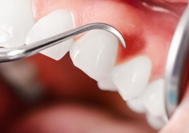 periodontologia – Saskie Centrum Zdrowia i Odnowy